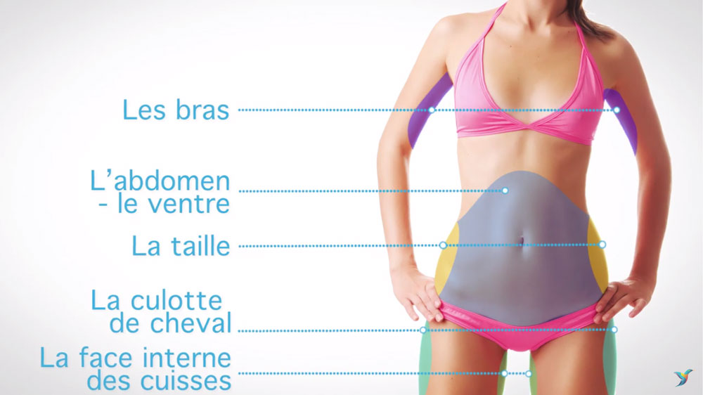 Centre-Marceau-les-zones-transformables-par-Cryolipolyse Centre-Marceau-les-zones-transformables-par-Cryolipolyse
